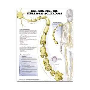 Understanding Multiple Sclerosis Anatomical Chart  