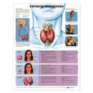  Thyroid Disorders Anatomical Chart Plastic Styrene 