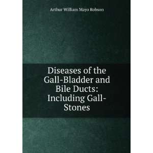   of the gall bladder and bile ducts Arthur William Mayo Robson Books