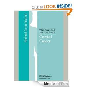What You Need To Know About Cervical Cancer National Cancer 