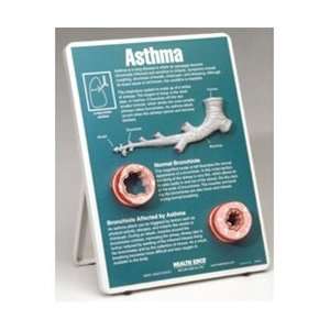  Asthma Easel Display Arts, Crafts & Sewing