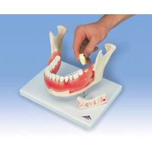  21 Part Dental Disease Model Magnified 2 times Health 
