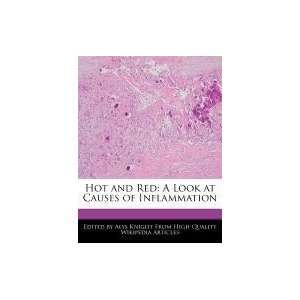  Hot and Red A Look at Causes of Inflammation 